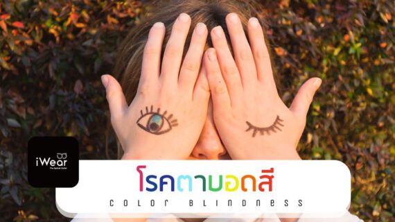 โรคตาบอดสี ( Color Blindness )
